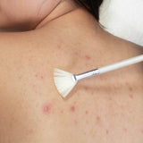 Back Peel