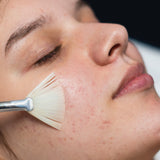 Custom Peel