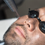 Hollywood Laser Facial