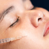 Melasma Fade