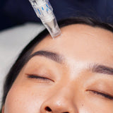 Skinpen